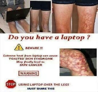 laptop can cause